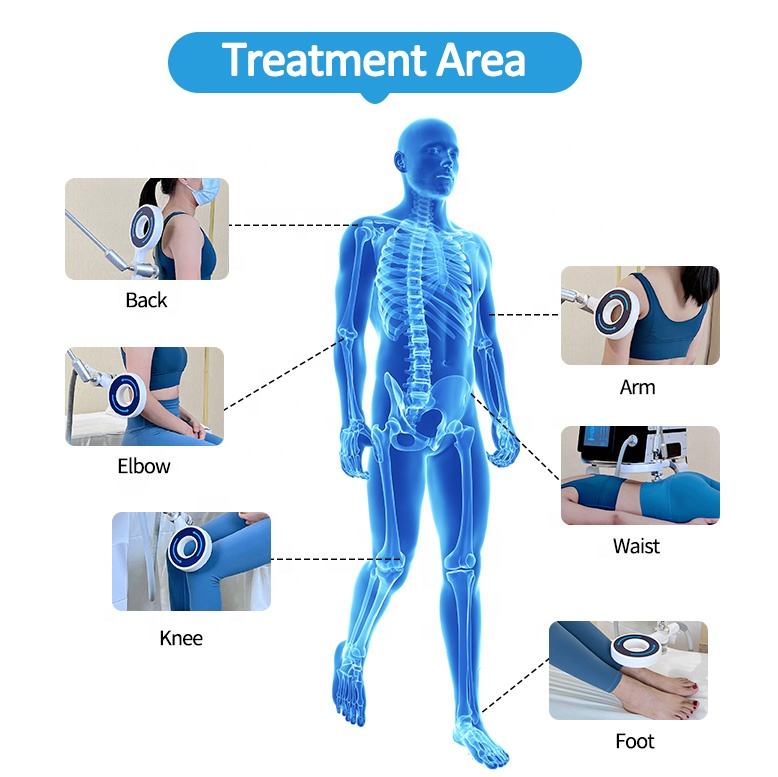 Extracorporeal Magneto Transduction Therapy Magnetic Therapy Degenerative Joint Diseases Sport Injuries for Fitness Beauty Salon Use