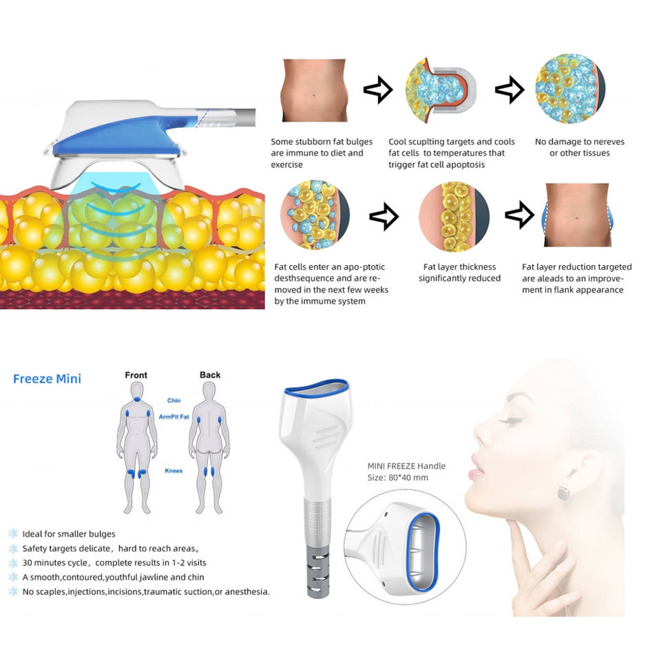New Sell 40K Vacuum Rf Cryolipolyse Weight Loss Fat Loss Machine Body Sculpt Body Slimming Body Contouring Body Shaping Equipment