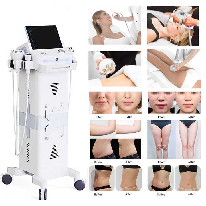 K6 Venuss Legacys Cavitation Cellulite Treatment Massage Multipolar RF Radio Frequency Laser Pad Vacuum Fat Removal Lipolaser Machine for Salon