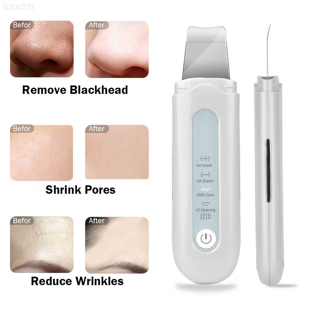 Electric Face Scrubbers 4 Modes EMS Ultrasonic Skin Scrubber Blackhead Remover Facial Cleanser Peeling Shovel Face Lifting Tool Spatula Deep Cleansing