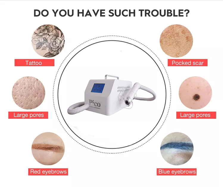 Latest Laser Pico Second Laser Remove Freckles Picosecond Laser Tattoo Removal Beauty Spa Remove Freckles