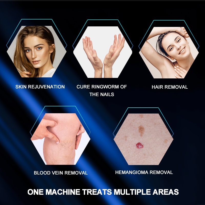 2024 Professional Long Pulse Nd Yag 1064nm Laser Machine Alexandrite 755nm Laser Hair Removal Acne Treatment Vascular Legions Remove Epilator Hair Rem