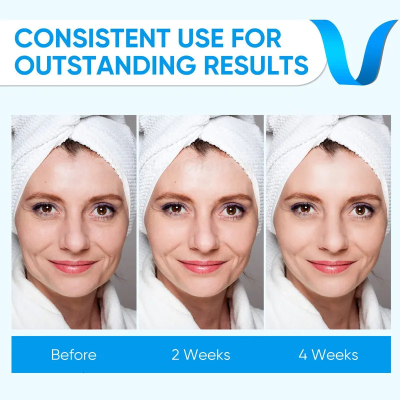 Face Massager V-Face Double Chin Eliminator Double Chin Reducer Machine Electric Face Lift Device Lifter Saggy Skin Reduce Double Chin 230927