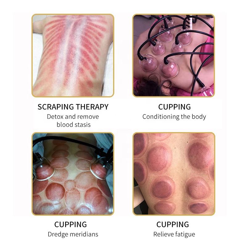 2023 Slimming Breast Enhancement Vacuum Butt Lifting Cupping breast massager