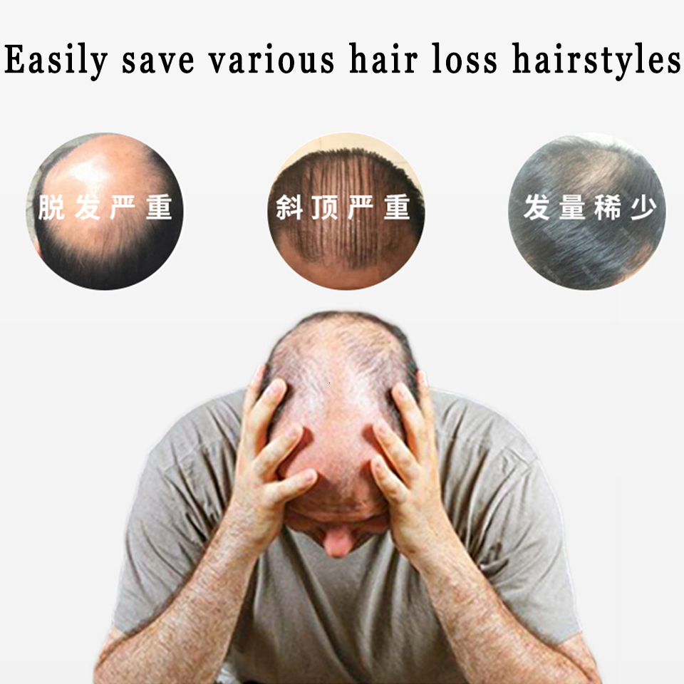 Synthetic s LUPU Short Replacement Hair Piece Fringe Top Clres pins For Men Baldness Clip In Natural 230114