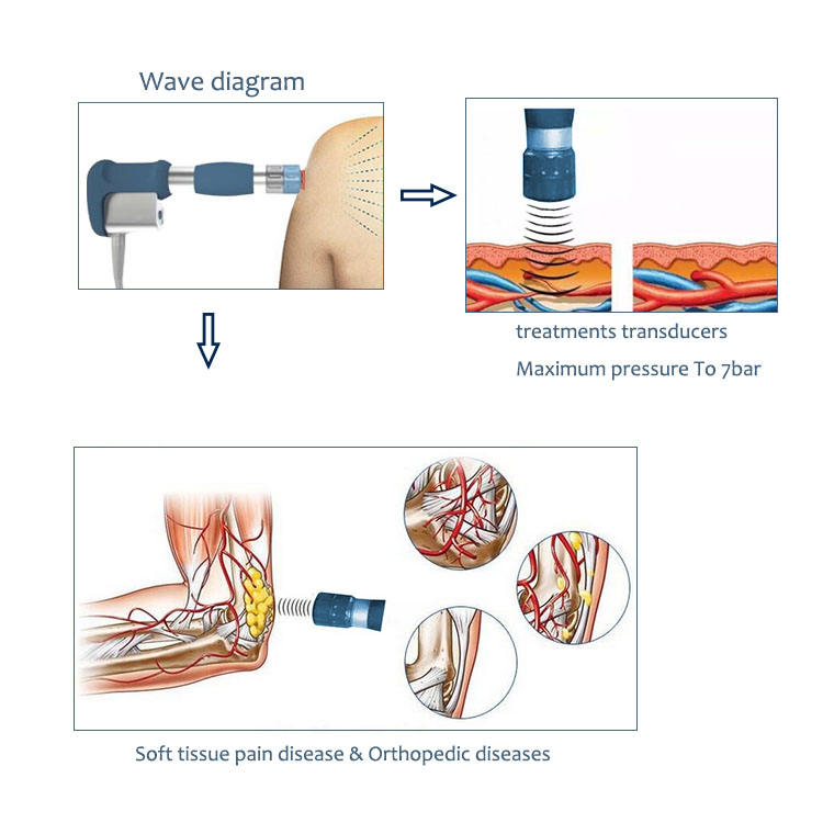 High energy Slimming shock wave shockwave therapy device for pain relief ED treatment machine