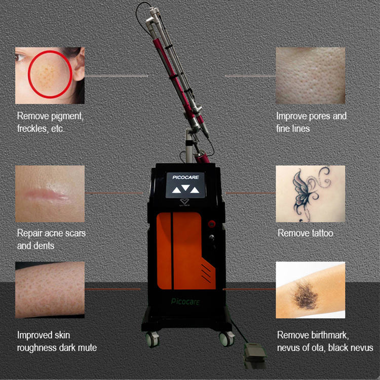 Laser color tattoo eyebrow remove Machine 532 1032 1064nm Q-switch ND Yag hair removal Speckle Pigment Acne Treatment beauty salon use