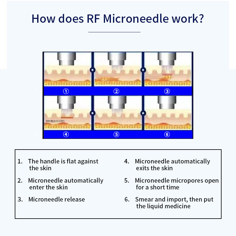 2023 Micro Needle Fractional Secret RF Golden Microneedling Machine For Acne Scars Removal Microneedle RF