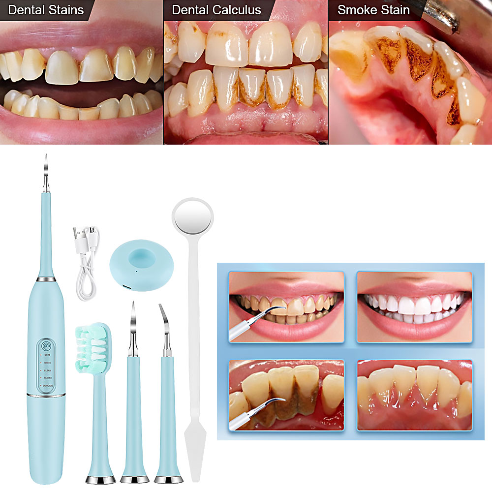 ultrasonic waterproof dental scaler for teeth tartar stain tooth calculus remover electric dental cleaner with 800mah battery electric sonic teeth ora