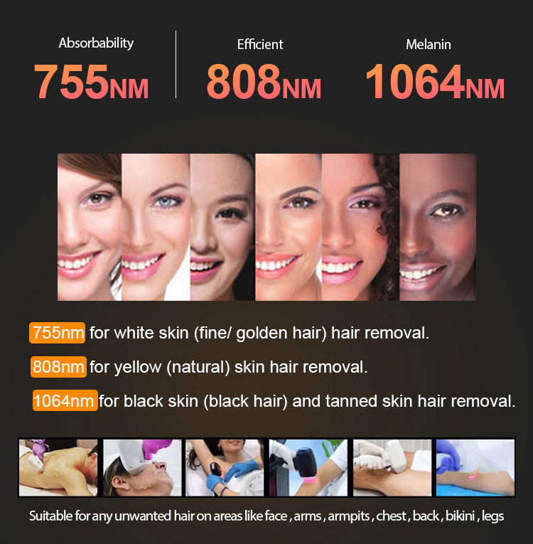Big Power 2000W Diode Laser 808 Hair Removal 3 Waves 755 808 1064 Hair Remover Machine Factory Price