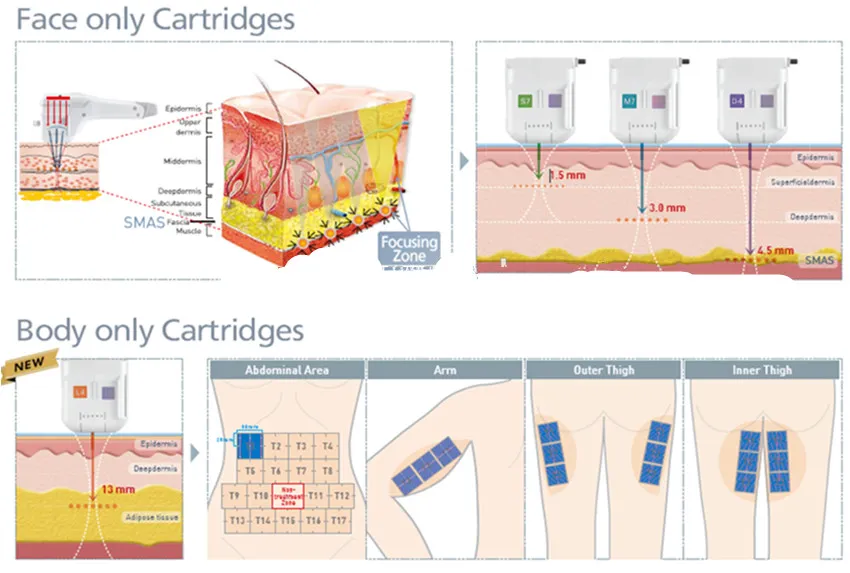 Newest Korea 12 Lines Machine Face Body 4d Hifu Anti wrinkle 5d Hifu Body Portable Mini Smas Lift Hifu Face Machines