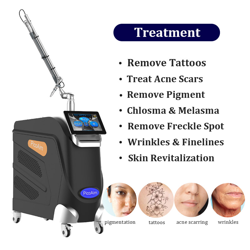 Vertical Picosecond Tattoo Removal Laser Machine Q Switched Nd Yag Laser Pico Pigment Removal Dark Spot Speckle Acne Removal Equipment
