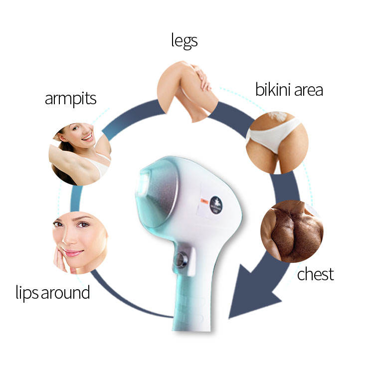 Immediate Effect Portable Permanent Hair Removal Device 755 808 1064nm 3 Waves Laser Technology Long-lasting Effect Skin Smooth Delicate Salon Beauty 