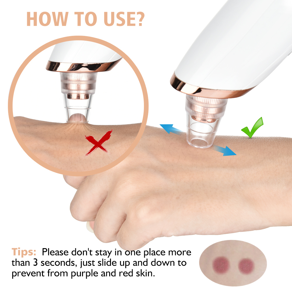 Cleaning Tools Accessories Blackhead Remover Vacuum Pore Cleaner Cleaning Black Dots Suction Exfoliating Beauty Acne Pimple Remover Tool Skin Care 230