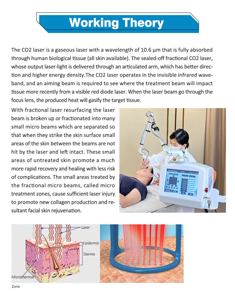 Vaginal Resurfacing Rf Excited Portable Co2 Fractional Laser