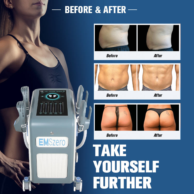 Ems Body Sculpting Machine 4 Handle Emslim Nova Neo RF EMS Muscle Stimulator Body Sculpt Emslim Machine Skin Firming