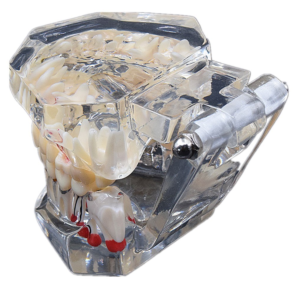 Other Oral Hygiene Dental Consumable Teeth Model Studying Implant Disease With Restoration Bridge Tooth Teaching 230831
