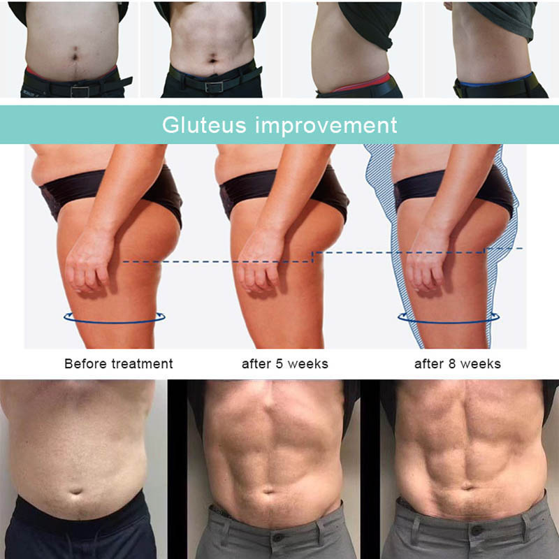 Portable emslim machines muscle stimulator ems slimming tesla sculpt body emt rf skin tighten machine 4 Handles