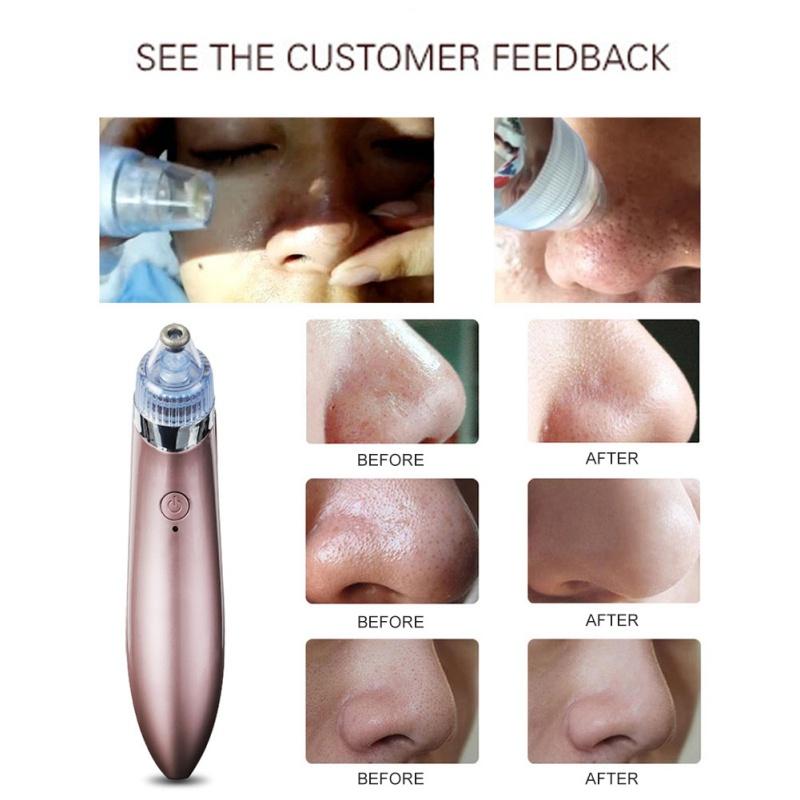 Other Beauty Equipment Skin Care Pore Vacuum Acne Pimple Removal Vacuum Suction Tool Facial Diamond Dermabrasion Machine Face Clean Blackhead Remover