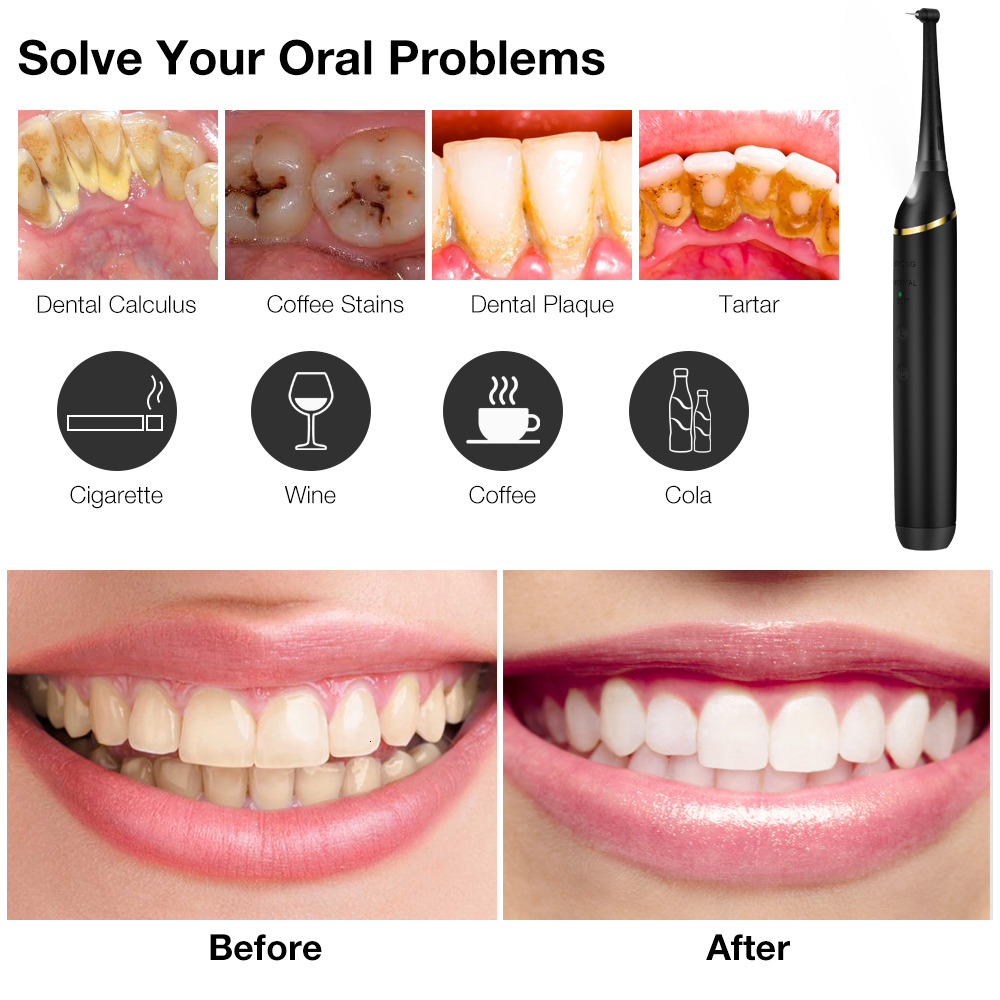 Other Oral Hygiene Portable Electric Sonic Dental Calculus Remover Tooth Polisher Tartar Plaque Stains Removal Oral Teeth Cleaner Whitening 230311