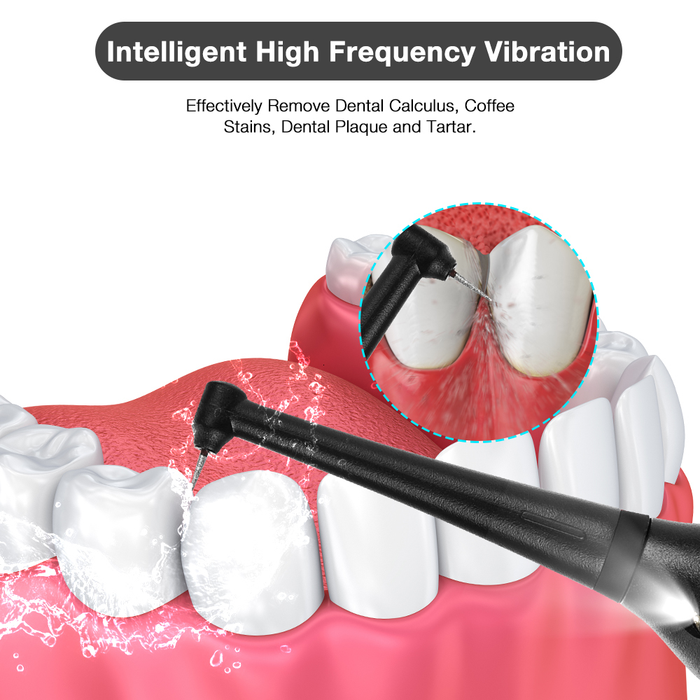Other Oral Hygiene Portable Electric Sonic Dental Calculus Remover Tooth Polisher Tartar Plaque Stains Removal Oral Teeth Cleaner Whitening 230311