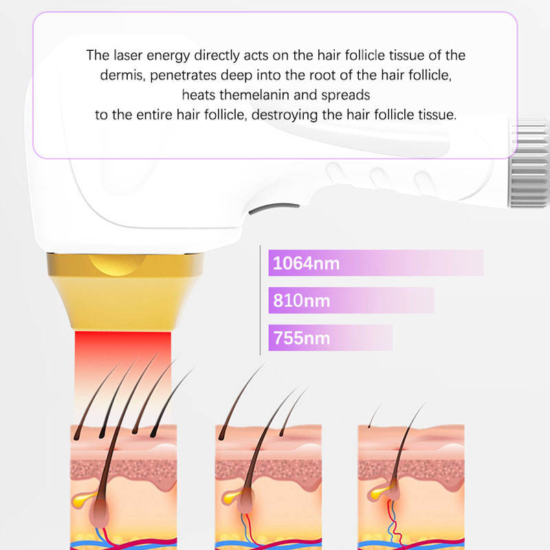 2023 810 808nm diode salon equipment laser hair removal removed hair laser
