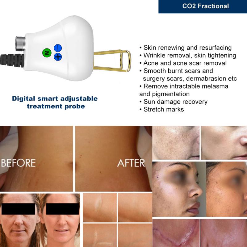 2023 Latest Co2 Fractional Laser Machine For Wrinkles Pore Scar Acne Removal Skin Rejuvenation Vaginal Tightening Beauty Face