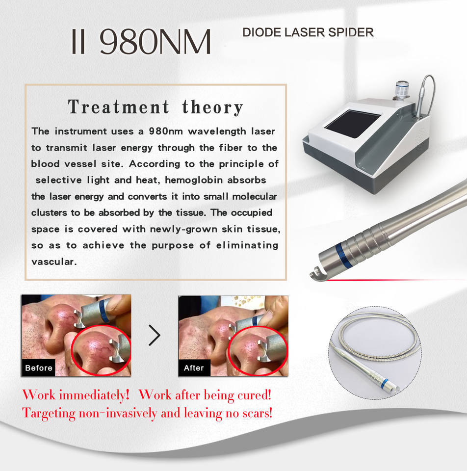 2in1 High Quality 30W Vascular Removal 980nm Diode Laser