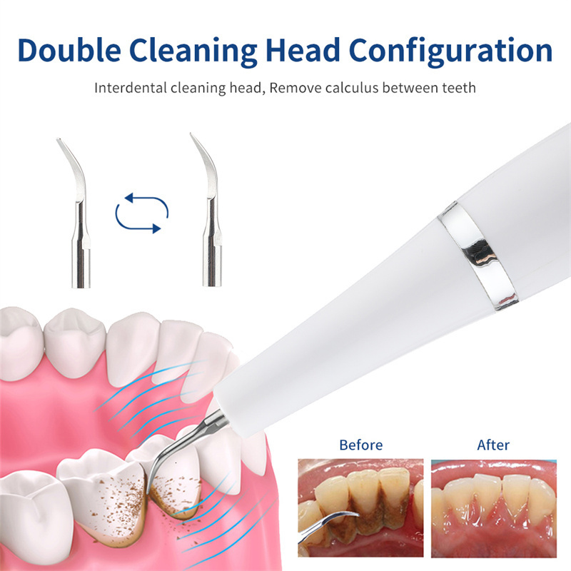 Other Oral Hygiene Ultrasonic Tooth Cleaner Teeth Whitening Visual Electric Dental Scaler For Teeth Cleaning Calculus Plaque Stains Tartar Removal 230