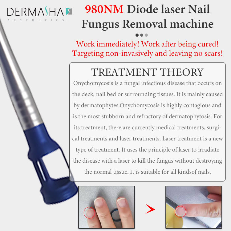 2in1 High Quality 30W Vascular Removal 980nm Diode Laser
