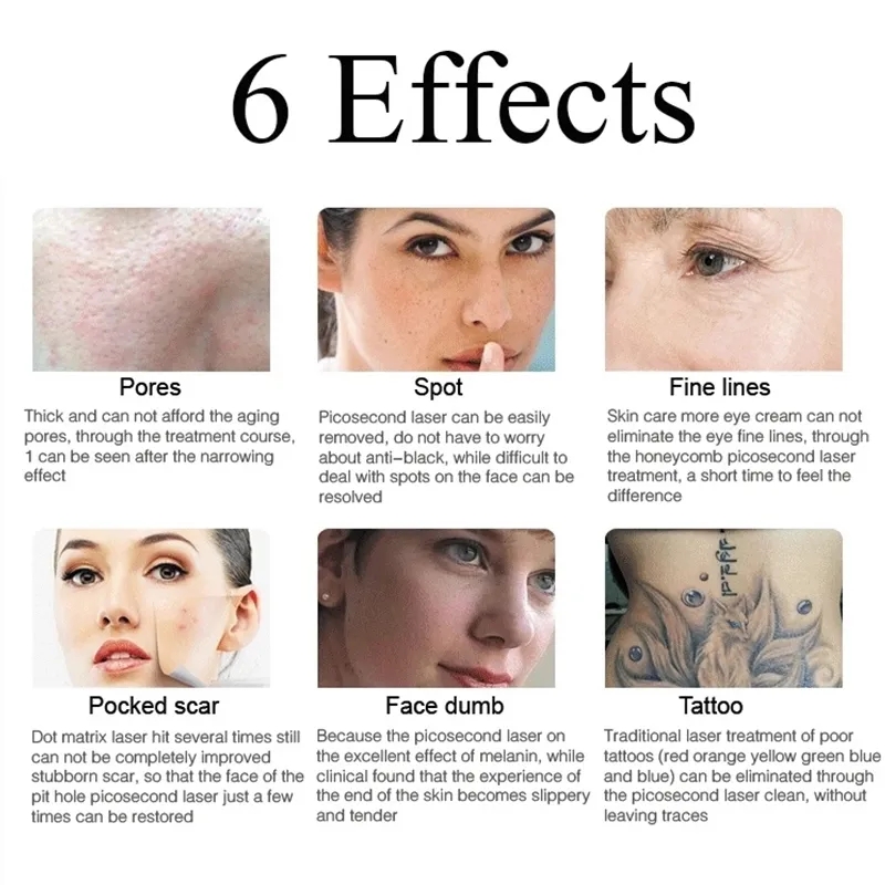 tattoo Removal Machine 1064nm 532nm 755mm 1320nm PicoS Laser Ance Remove Skin Rejuvenation Beauty Equipment Multi Language Support