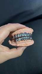 Custom Made Dental Grills Iced Out Sterling Silver Real Gold Jewelry Zigzag Setting VVS Moissanite Diamonds Teeth Grillz