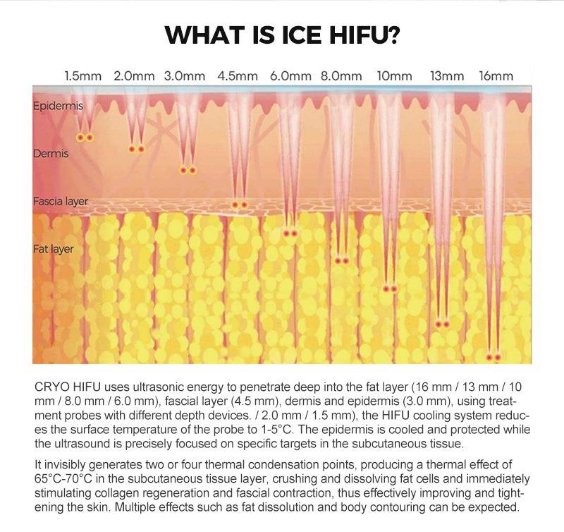 anti aging hifu rf with cooling machine ice hifu cool hifu portable machine korea skin tighten device vaginal rejuvenation