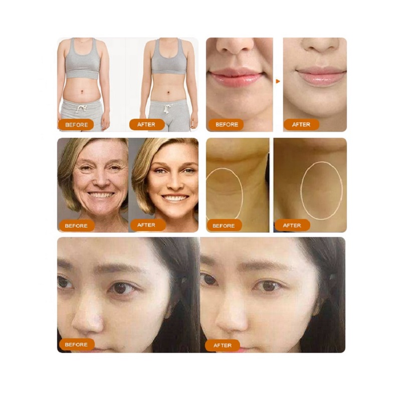 hifu face lifting body slimming machine skin tighten hifu 7d facial y corporal 10 lines machine face and body korea hifu machine