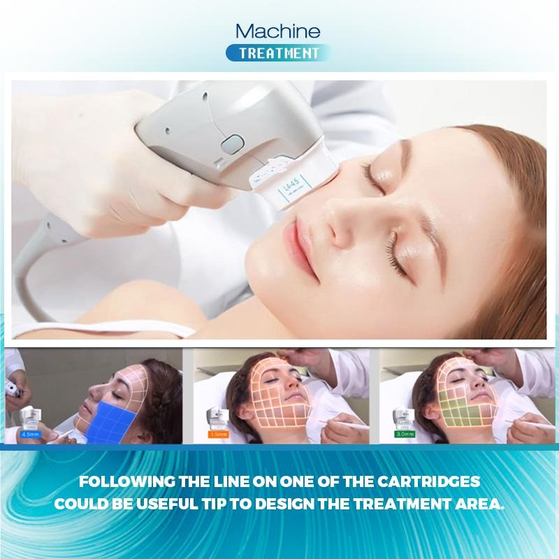 professional 7D HIFU SMAS Ultrasound slimming anti-wrinkle face lifting 20000 shots each Cartridge skin tightening repairing skin damage anti-age beau