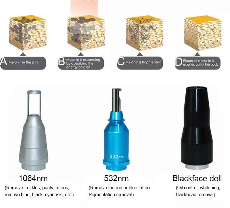 2025 Best Selling Most Popular Q Switched Nd Yag Laser Painless Tattoo Removal Machine Pick Pico Laser Eyebrow Washing