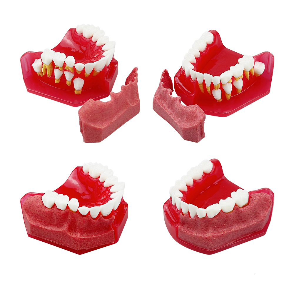 Other Oral Hygiene Dental Tooth Model Children Primary Permanent Teeth Alternate Deciduous Resin Teeth Model For Studying Teaching Communication 23051