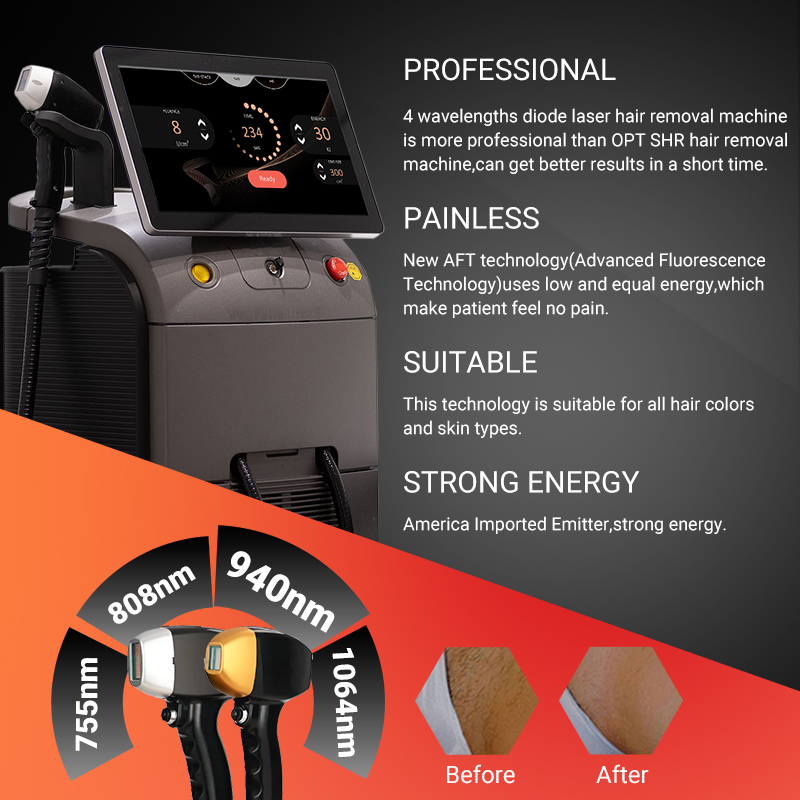 best lezar professional laser diode 755 808 1064 hair removal machine 2 handles long life use