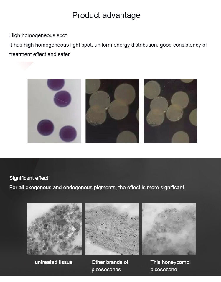 755nm 532nm 1064nm Picosend Tattoo Removal Picolaser Laser Nd Yag Portable Laser Tattoo Removal Machine Black Skin Use Laser 3 Wavelength Spot Remover