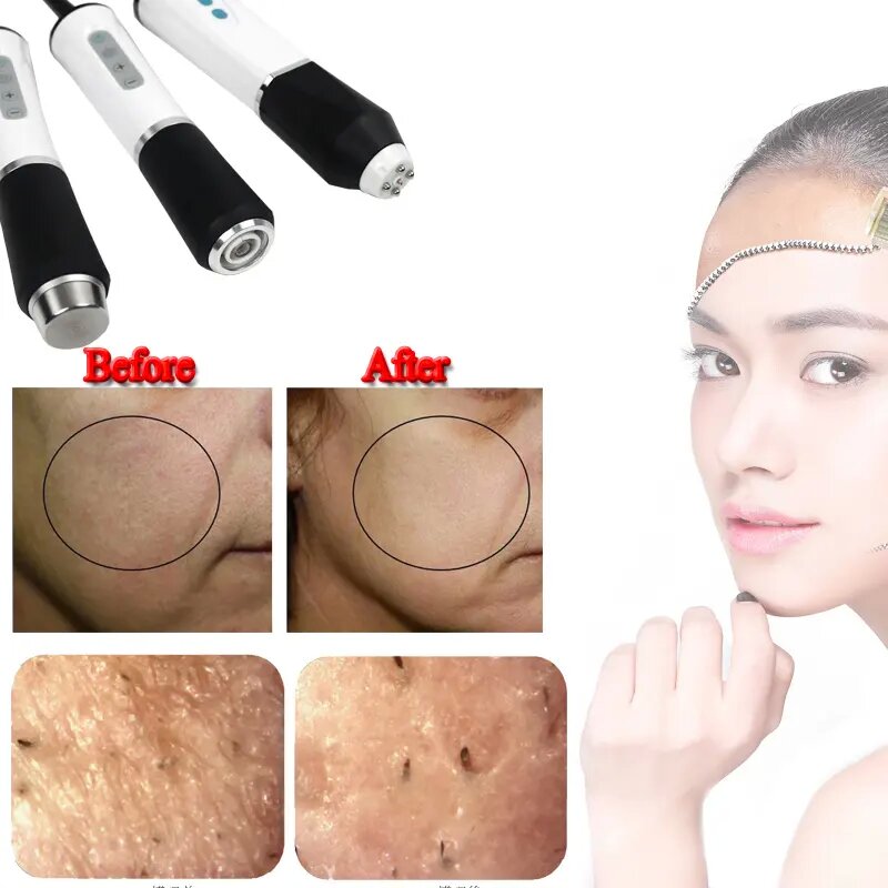 Portable 3 In 1 Oxygen Jet Peel Bubble Exfoliate Facial Cleansing Machine Ultrasonic Rf Wrinkle Removal Face Lifting Machine
