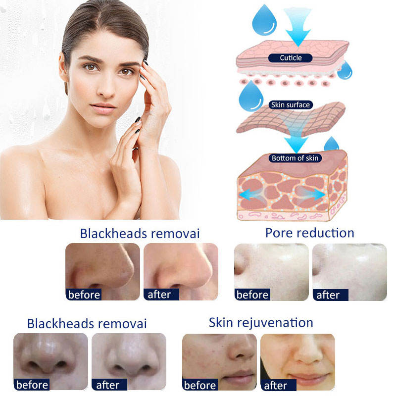 2023 14 in 1 Hydro Microdermabrasion Skin Lifting Device Multifunction High Frequency Facial Spa Ultrasound BIO Water Dermabrasion Moisturizer Machine
