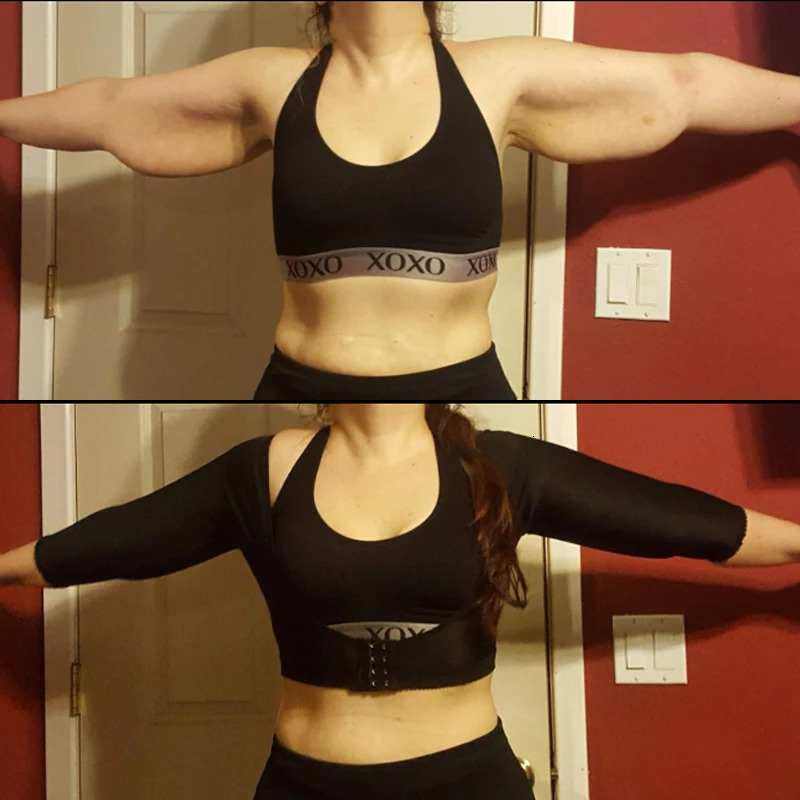 Arm Shaper Women Upper Arm Shaper Post Slimmer Compression Sleeves Humpback Posture Corrector Tops Shapewear for Women 231202