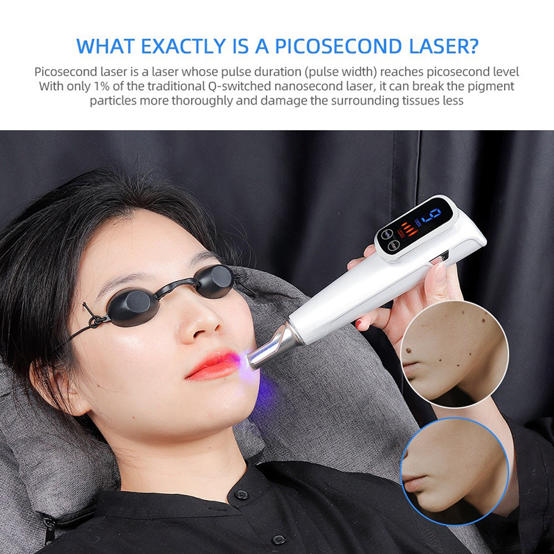 New Wireless Picosecond Laser Tattoo Removal Pen Skin Rejuvenation Facial Care Pico Laser Pen Freckle Cleaner Mole Dark Spot Pigment Remover Red Blue 