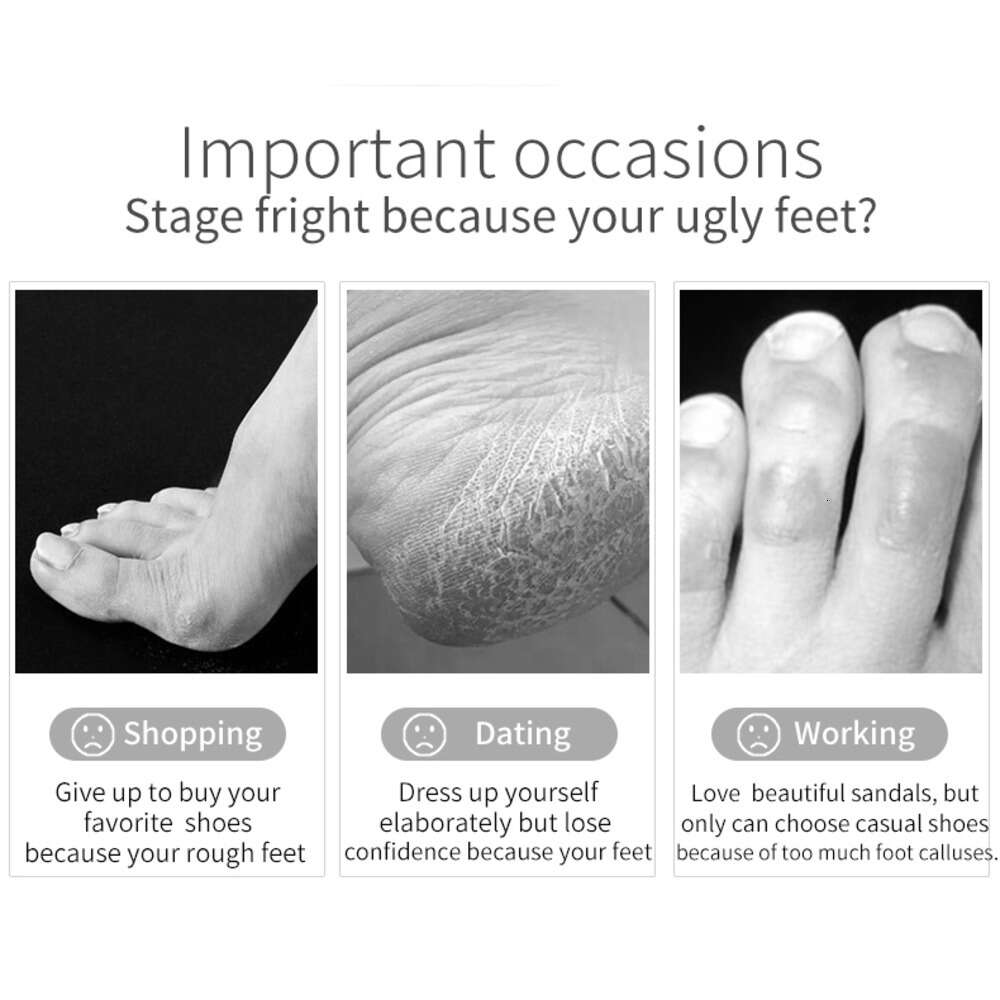 Exfoliating Foot Mask Socks For Pedicure Baby Foot Peel Feet Mask Skin Care Cosmetics Peeling Foot Health Calcetines Exfoliantes Para Mascarillas De P