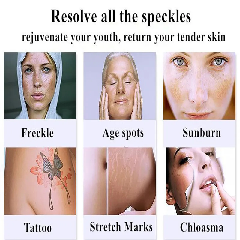 4 In 1 360 Magneto Optic Laser Hair Removal Nd Yag Laser Tattoo Removal RF Rejuvenation Machine