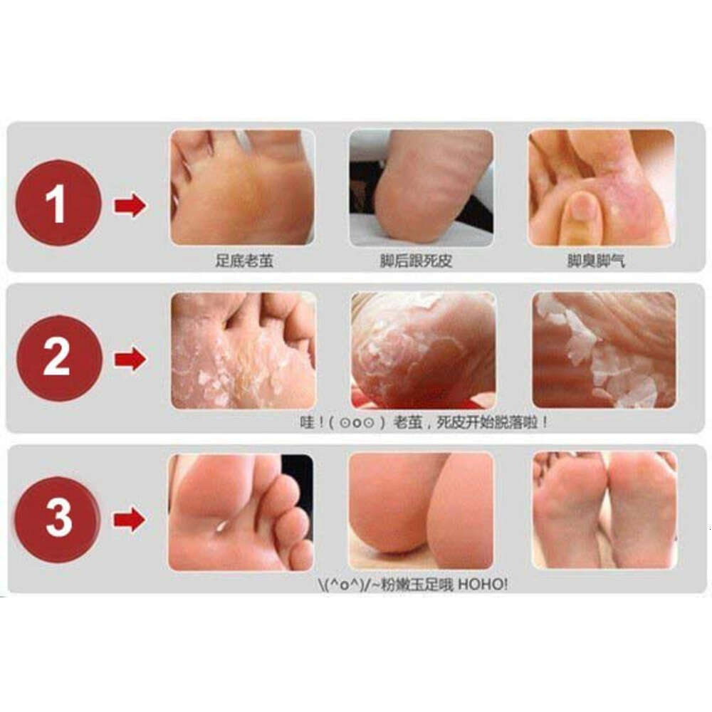 1000pcs 500pairs Foot Skin Smooth Milk Bamboo Vinegar Remove Dead Skin Exfoliating Feet Mask Foot Remove Old Skin Mascarilla Exfoliante Para Pies Whol