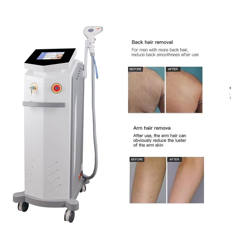 High Quality Painless 808nm Diode Laser Hair Removal Machine Professional Salon Epilator Alexandrite Lazer Hairs Remove Beauty Equipment