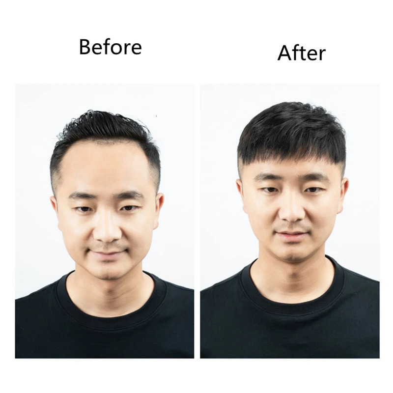 Men's Children's Wigs Men's Toupee Human Short Hairpiece Natural Forehead Hairline Patch For Men V Style Front Male Remy Hair With Thin