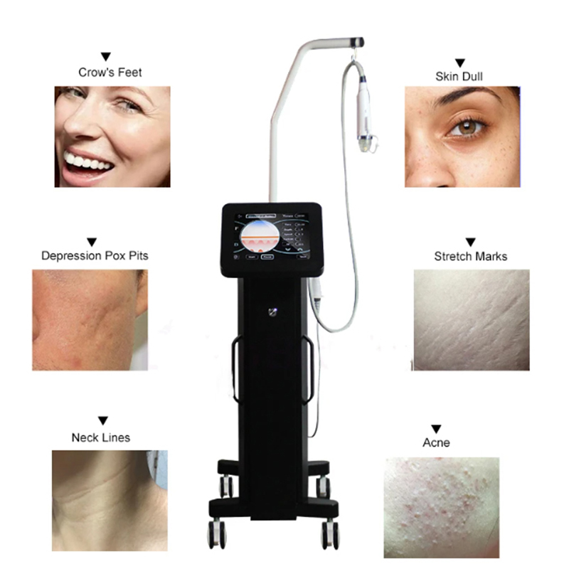 Vertical Gold Radio Frequency Microneedle Device Home Use RF Beauty Instrument Skin Rejuvenation Tightening Acne Scar Stretch Mark Treatment