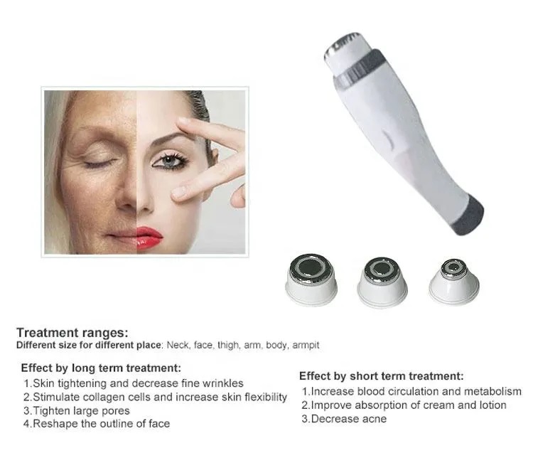 2024 Hot Selling 3/4 Handles IPL OPT RF Nd YAG Laser Tattoo Removal Skin Rejuvenation Whitening Tightening 4 in 1 OPT Hair Removal Permanent Machine
